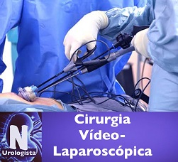 Cirurgia Vídeo-Laparoscópica